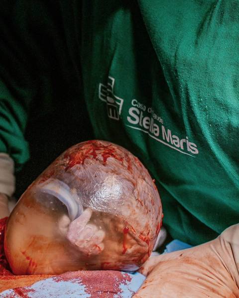 Fotografia de parto'