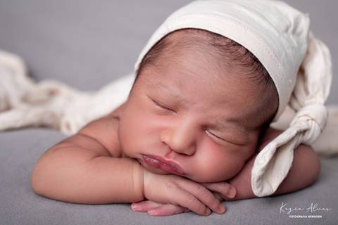 BOOK DE RECEM NASCIDO'