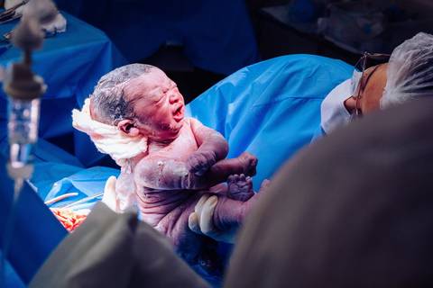 Parto no Complexo Hospitalar de Niterói (CHN) '