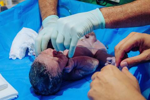 Parto no Complexo Hospitalar de Niterói (CHN) '