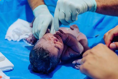 Parto no Complexo Hospitalar de Niterói (CHN) '