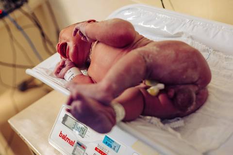 Parto no Complexo Hospitalar de Niterói (CHN) '