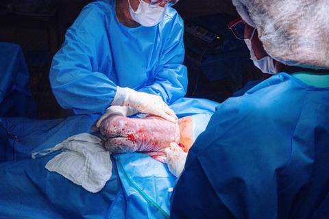 FotÓgrafo de parto em niterói RJ'