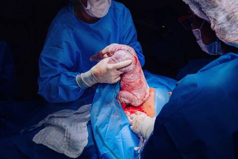 FotÓgrafo de parto em niterói RJ'