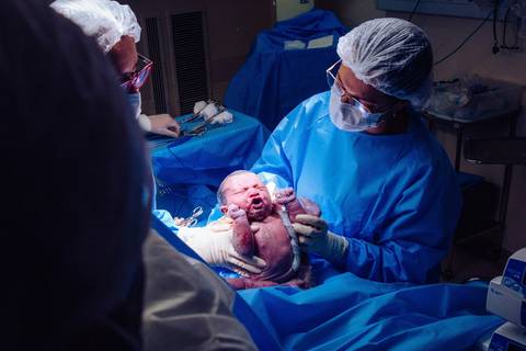 Parto no Complexo Hospitalar de Niterói (CHN) '