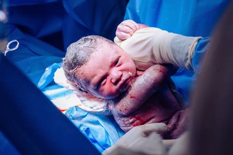 Parto no Complexo Hospitalar de Niterói (CHN) '