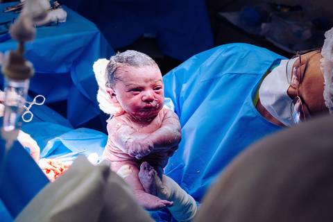 Parto no Complexo Hospitalar de Niterói (CHN) '