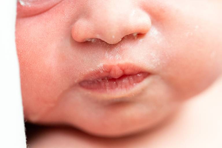 detalhes da fotografia de parto