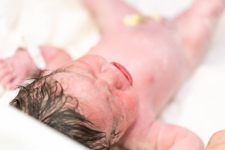 fotografia de parto na maternidade 