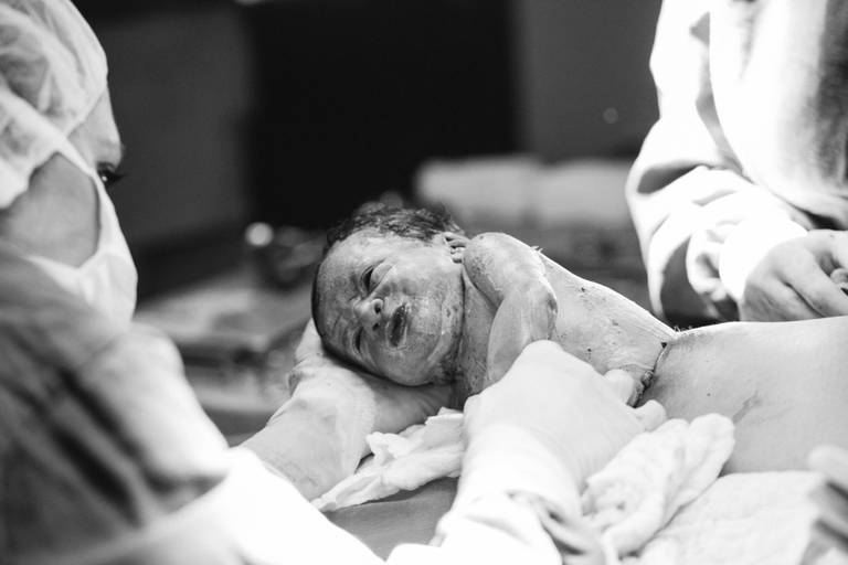 fotografia de parto