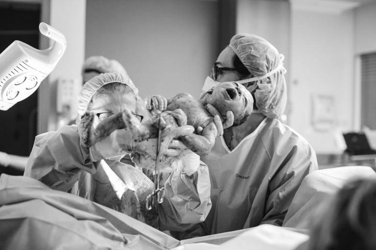 fotografa para parto normal