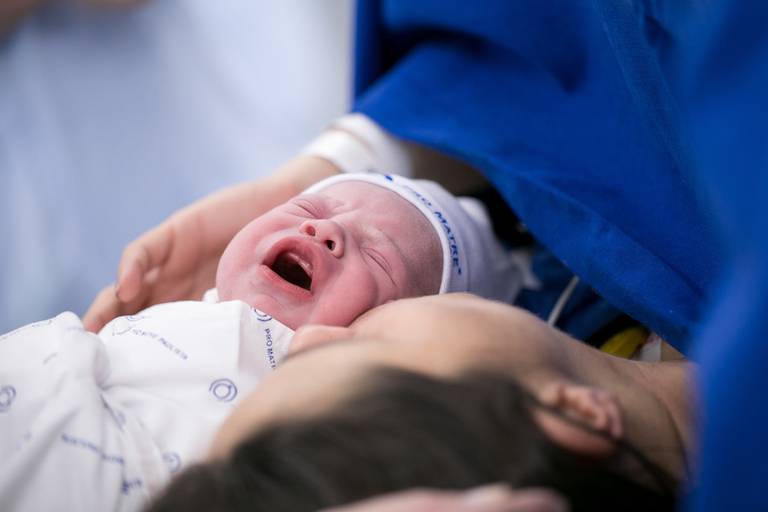 fotografia profissional de parto