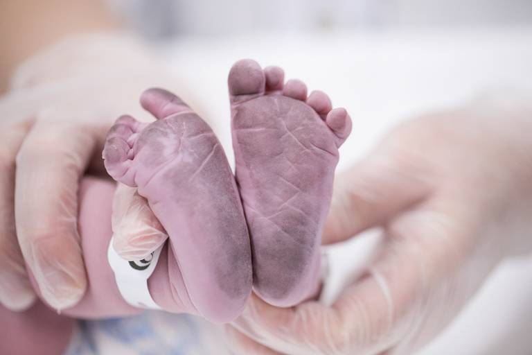 detalhes das fotos de parto