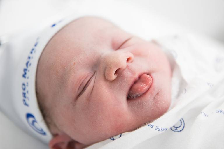 registro fotografico de parto