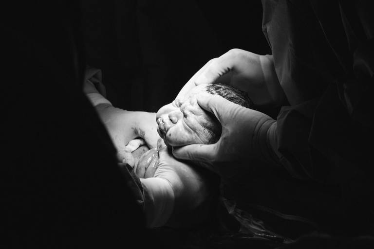 fotografia profissional de parto