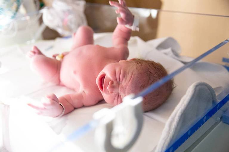 fotos na hora do parto