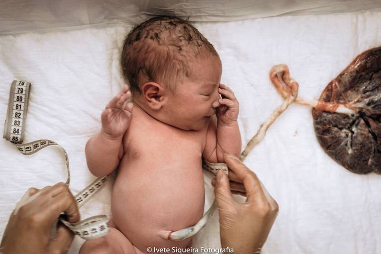 Fotografia de Parto Humanizado