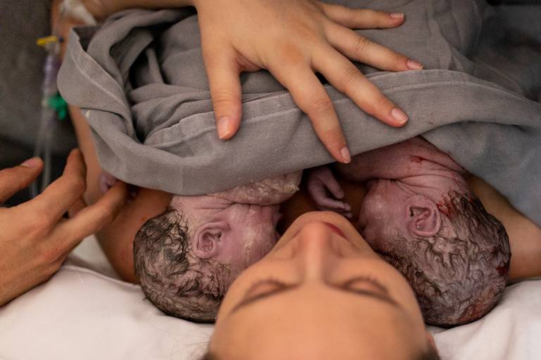 Fotografia de Parto Humanizado