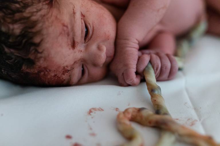 Fotografia de Parto Humanizado