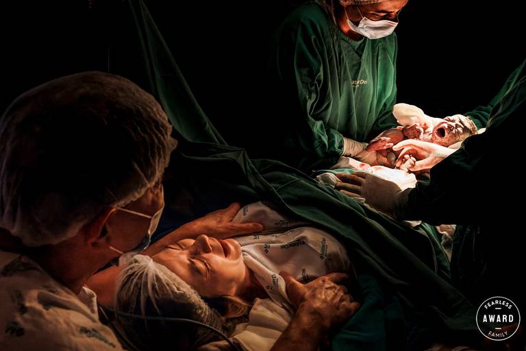 Adriana Costa foi premiada pela Fearless Family pela foto de uma cesariana que mostra a emoção da mãe ao ver o seu bebê nascer 