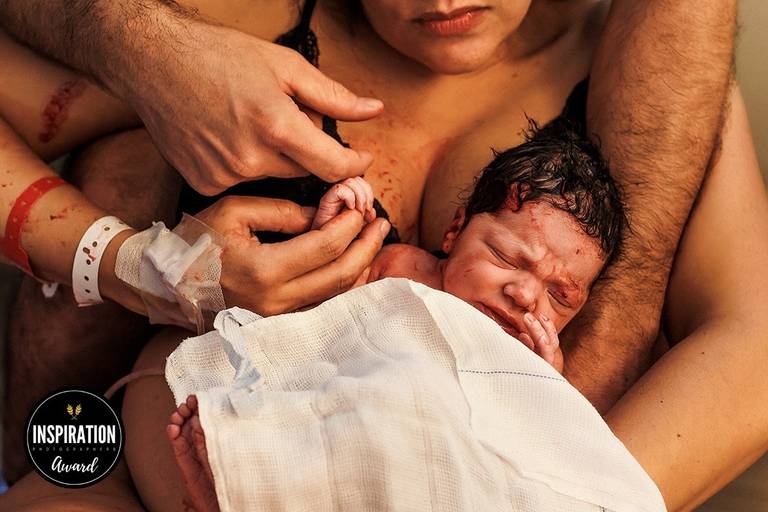 Adriana Costa foi premiada pela Inspiration Family Awards pela foto do primeiro contato dos pais com sua bebê logo após o nascimento