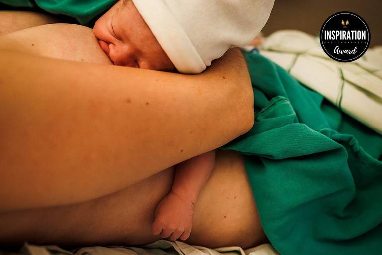 Adriana Costa foi premiada pela Inspiration Family Awards pela foto do gostoso relaxamento do bebê ao amamentar em contato direto com a pele da mãe após o nascimento durante a importantíssima Hora de Ouro