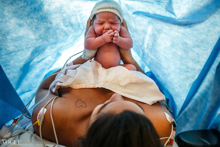 Foto de Adriana Costa selecionada para a galeria da Vogue Itália de uma mãe admirando seu bebê que acabou de nascer por uma cesárea durante a Hora de Ouro
