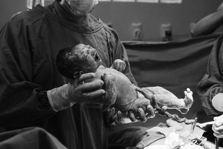 bebê chorando no parto