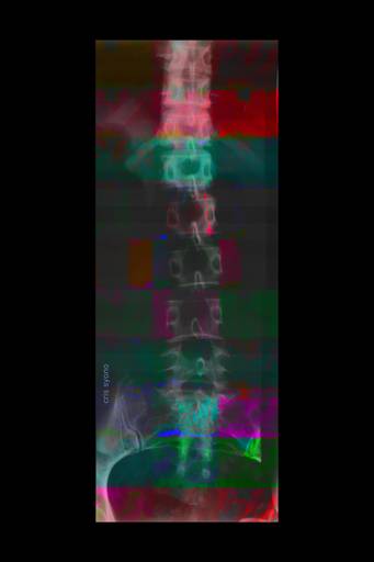 COLUNA 1
C.Y.S. 2008
cristina syono
foto-arte-psicoterapia