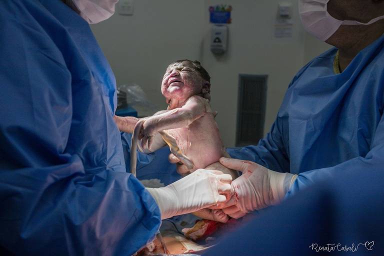 Bebe Cath Mae Lud Obstetra Sonia