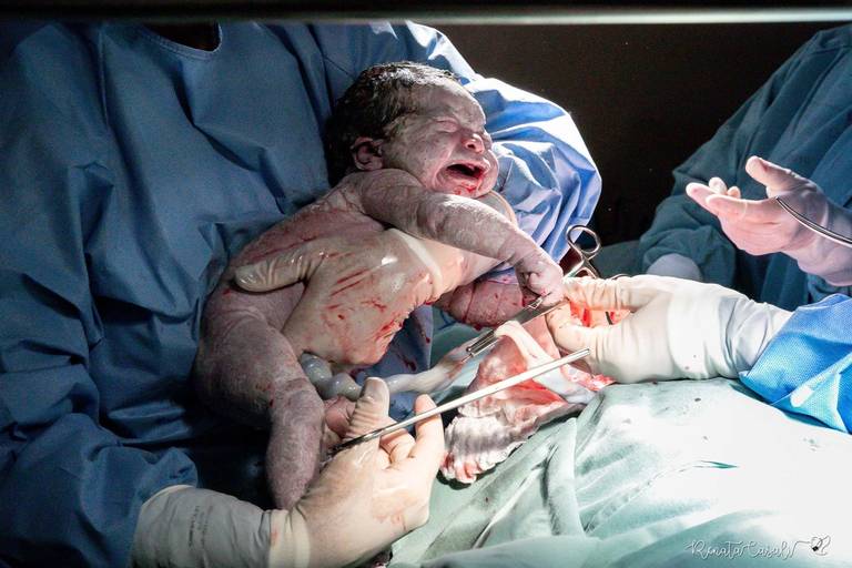 Malu  obstetra neilda barreto mae clara