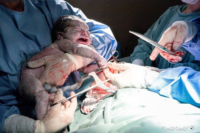 Malu  obstetra neilda barreto mae clara