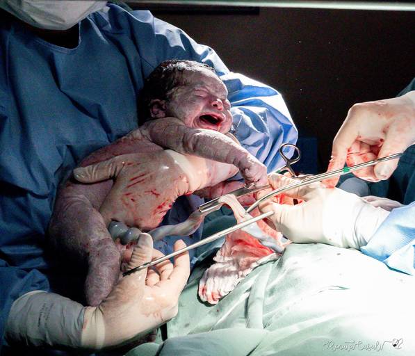 Malu  obstetra neilda barreto mae clara