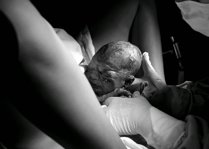 fotografia de parto Campinas