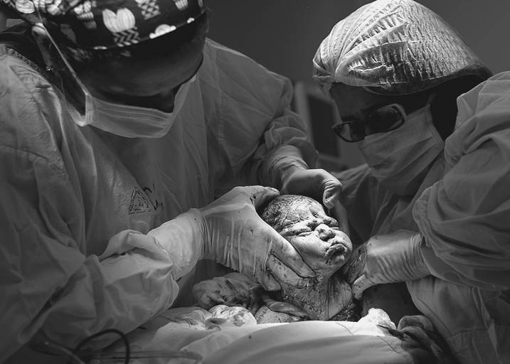 fotografia de parto Campinas