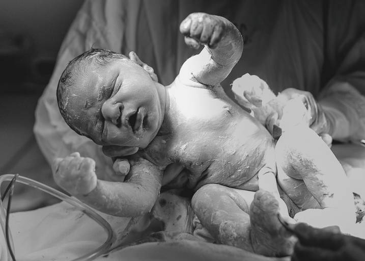 fotografia de parto Campinas
