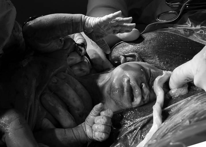 fotografia de parto Campinas