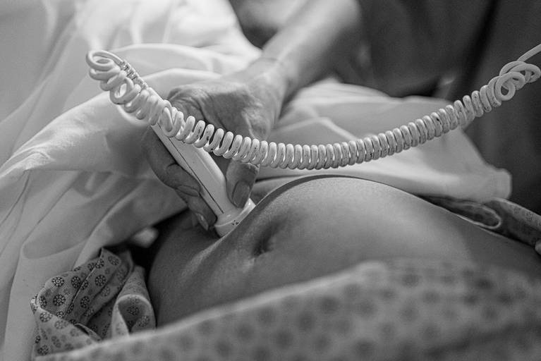 fotografia de parto Campinas