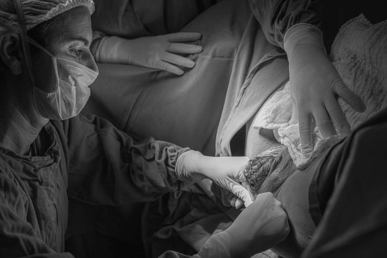 fotografia de parto Campinas