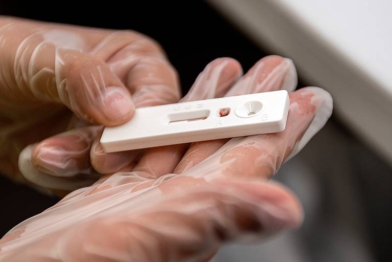 #CamiãodaEsperança #covid19 #teste