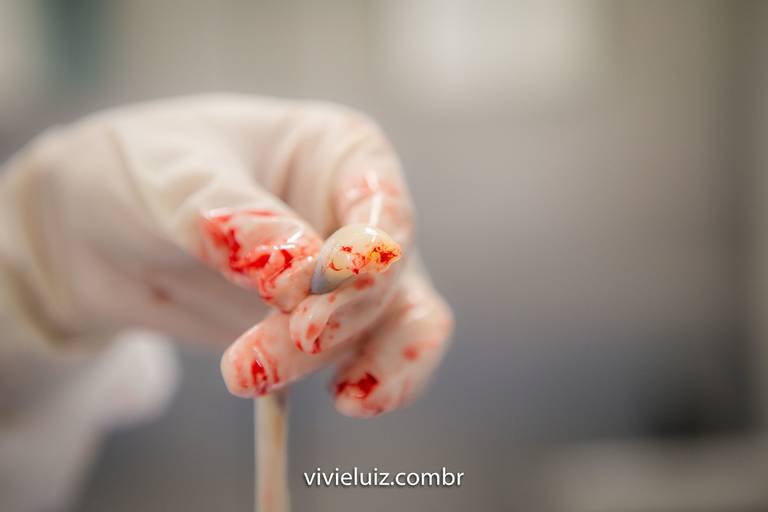 mão da médica após o parto