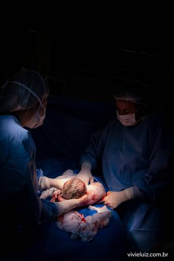 médicos prontos para o parto