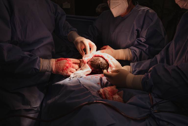 fotografia de parto recife Isabela Lucena fotografia