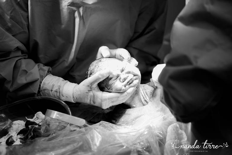 parto-nascimento-newborn-fotografia-foto-fotografa-bebê-berçario-recem-nascido-maternidade-mãe-família-nanda-tirre-cesarea-natural-humanizado-obstetra-pediatra-perinatal-hctco-idealiza-hospital-clinicas-doula-nascer-nasceu-teresopolis-rj-rio de janeiro