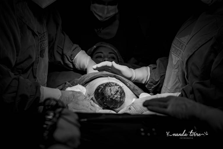 parto-nascimento-newborn-fotografia-foto-fotografa-bebê-berçario-recem-nascido-maternidade-mãe-rio-de-janeiro-rj-família-nanda-tirre-cesarea-natural-humanizado-obstetra-pediatra-perinatal-hctco-idealiza-hospital-clinicas-doula-nascer-nasceu-teresopolis
