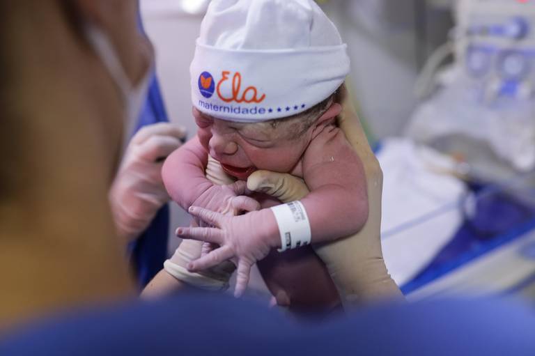 E as expressões são as melhores