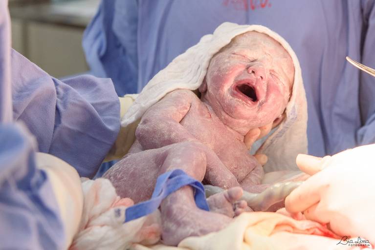 Parto cesárea Campinas 