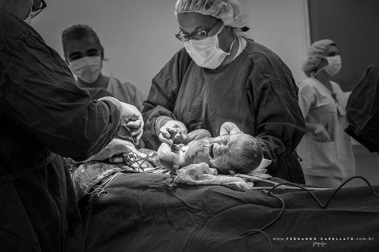 Fotografia de Parto - Hospital e Maternidade Pro Matre Paulista - SP - fotografia de parto, parto sjc, parto sp, fotografia de parto sjc, fotografia de parto sp, foto de parto, foto de parto sp, foto de parto sjc