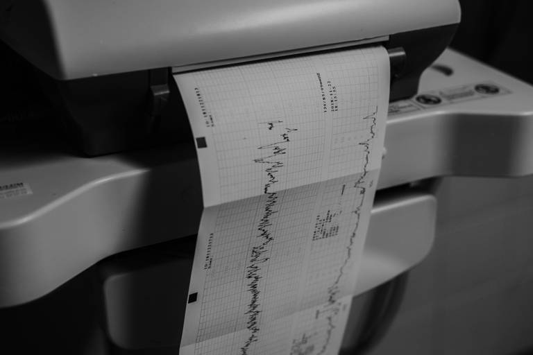 fotografia de parto, sessão fotografica parto, reportagem nascimento, melhores fotografos de parto em portugal, hospital povoa de varzim, parto humanizado, parto positivo, gravidez, nascimento