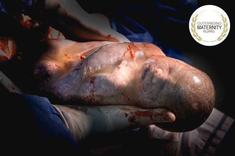 OUTSTANDING MATERNITY